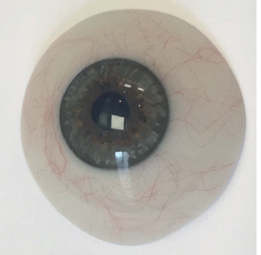 Verre scléral prothétique, sclère opaque et pupille noire