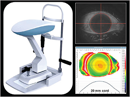 Topographe Profiler Eaglet Eyes lentilles sclérales