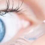 Les cas d'utilisation d'une lentille de contact sur mesure