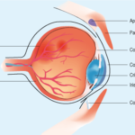 Lentille de contact pour oeil sec
