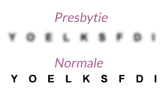 vue presbytie