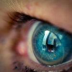 Les 3 étapes d'adaptation des lentilles de contact