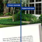 Les avantages de lentilles progressives pour les presbytes