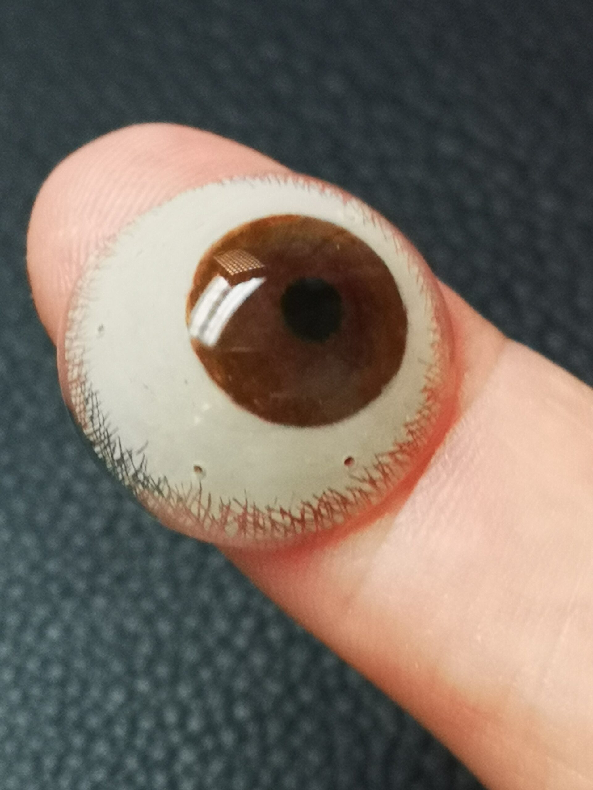 lentille sclérale souple esthétique
