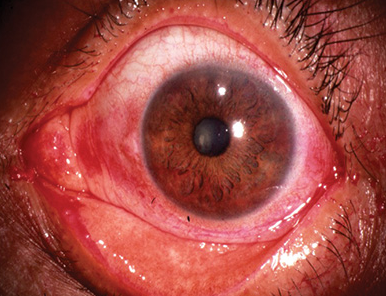 cigarette électronique allergie yeux Comment choisir son taux de nicotine pour sa cigarette électronique ?  Planet Vapo main image 1
