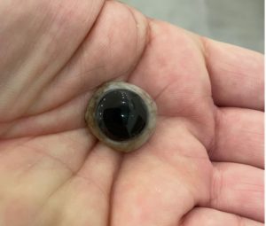 Prothèse réalisée selon la forme adaptée