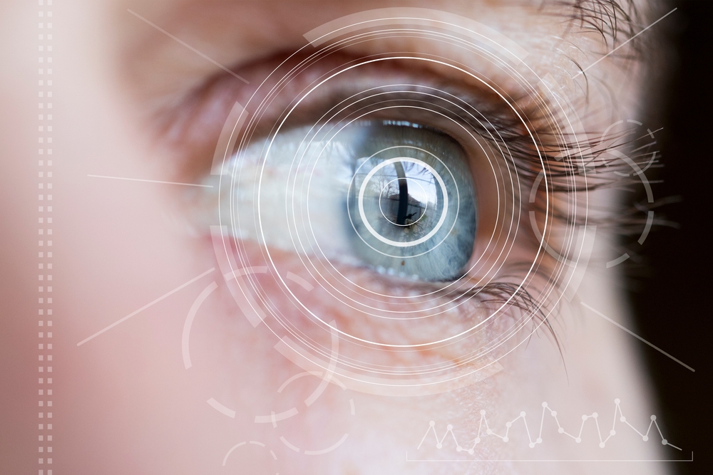 Lentilles sclérales pour corriger un keratocone