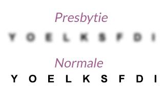 Les presbytes : peuvent-ils s’équiper en lentilles de contact ?