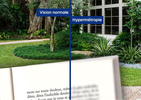 Les avantages de lentilles progressives pour les presbytes