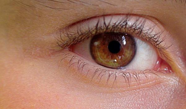 Quelles sont les avantages des lentilles toriques pour l’astigmatisme ?