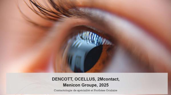Congrès 2025, DENCOTT, OCELLUS, 2MCONTACT, MENICON Groupe