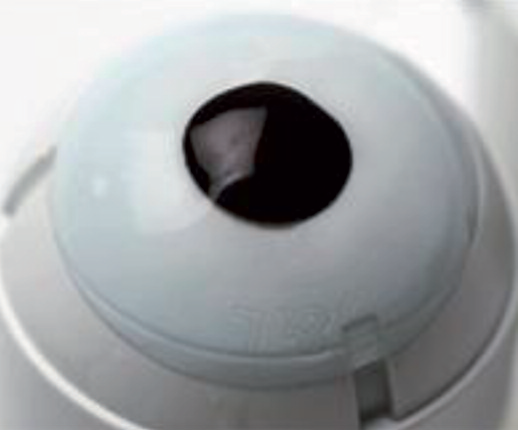La prothèse oculaire en cinq questions ?