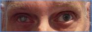 Prothese oculaire laboratoire Dencott Avant 4