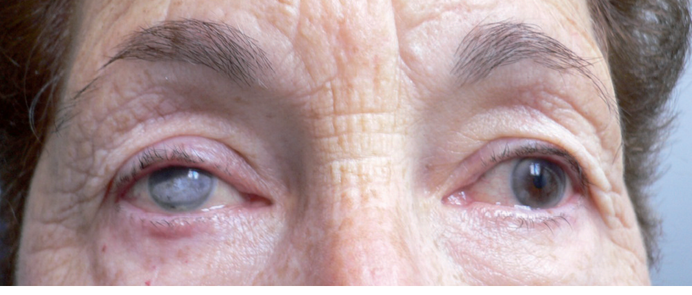 esthecolor à iris peint avant