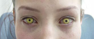 Lentilles de contact pour effets spéciaux